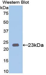 KRT23 / Keratin 23 Antibody (aa243-382)