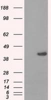 PME-1 / PPME1 Antibody (clone OTI10A12, Carrier-free)