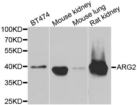 Polyclonal Rabbit anti-Human ARG2 / Arginase 2 Antibody (WB)