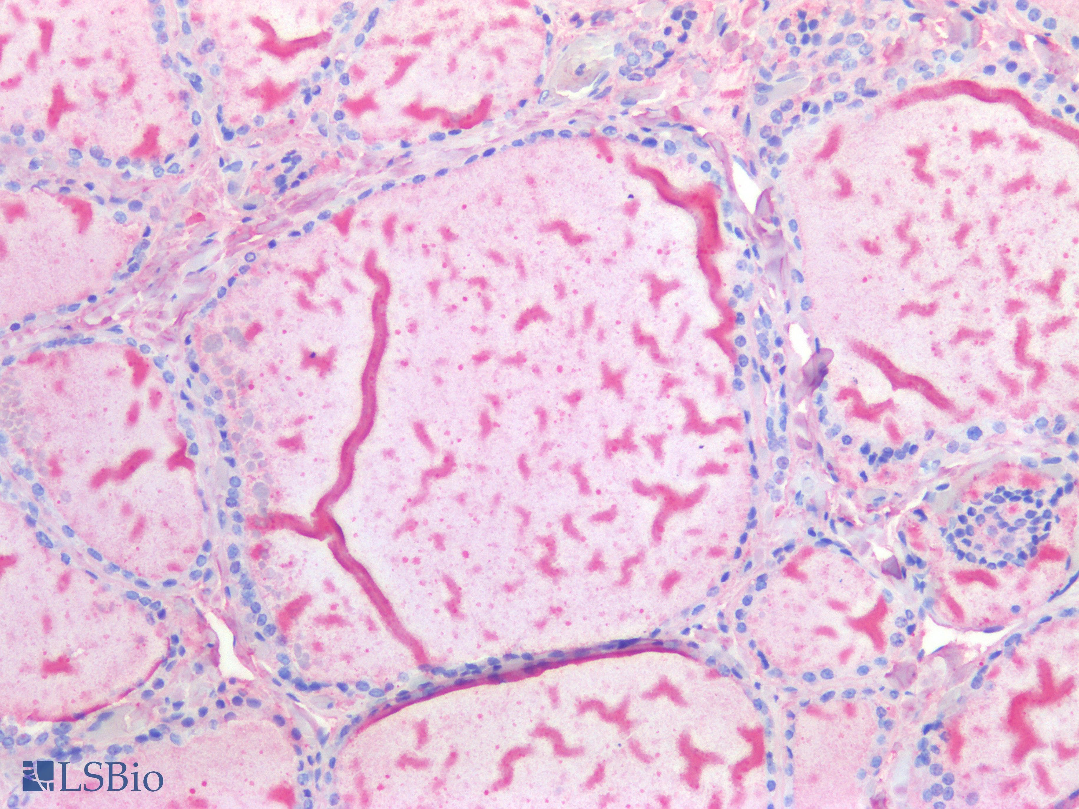 PathPlus™ Monoclonal Mouse anti-Human TG / Thyroglobulin Antibody (IHC)