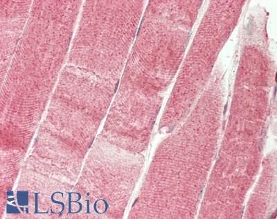 IHC-plus™ DNM2 / Dynamin-2 Antibody (aa625-675)