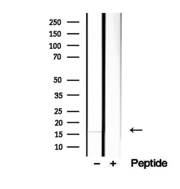 HBE1 / Hemoglobin Epsilon 1 Antibody
