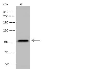 NCAM / CD56 Antibody