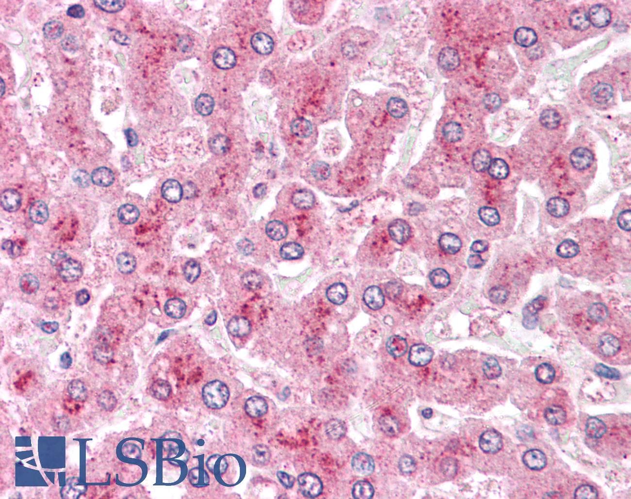 IHC-plus™ Polyclonal Rabbit anti-Human GPC4 / Glypican 4 Antibody (N-Terminus, IHC)