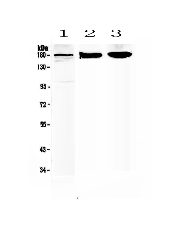 Polyclonal Rabbit anti-Human ABCC8 / SUR1 Antibody (IHC, WB)