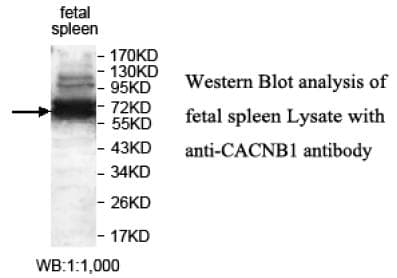 Polyclonal Rabbit anti-Human CACNB1 Antibody (C-Terminus, IHC, WB)
