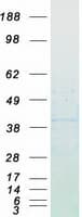 Human CCND1 / Cyclin D1 Protein (Recombinant Myc-DDK (Flag))