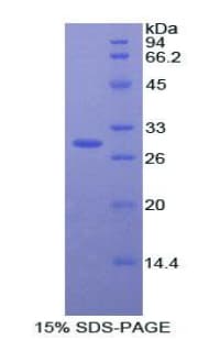 Rabbit ACP5 / TRAP Protein (Recombinant His)