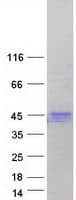 Human HFE Protein (Recombinant Myc-DDK (Flag))