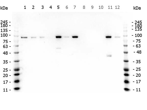CTNNB1 / Beta Catenin Antibody (C-Terminus)