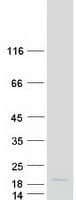 Human PIP / GCDFP-15 Protein (Recombinant Myc-DDK (Flag))