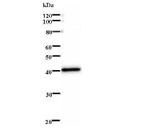 MXI1 / MAD2 Antibody (clone MXI1C2a)