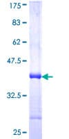 Human LAMP2 / CD107b Protein (Recombinant GST, N-terminus)