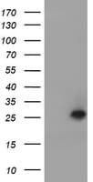 UBE2E3 Antibody (clone OTI1D12)