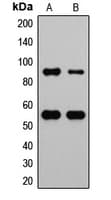 Polyclonal Rabbit anti-Human MDM2 Antibody (phospho-Ser166, IHC, IF, WB)