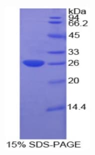 Rat CTF1 / Cardiotrophin-1 Protein (Recombinant His-T7)