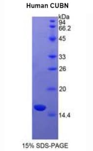Human CUBN / Cubilin Protein (Recombinant His, N-Terminal)