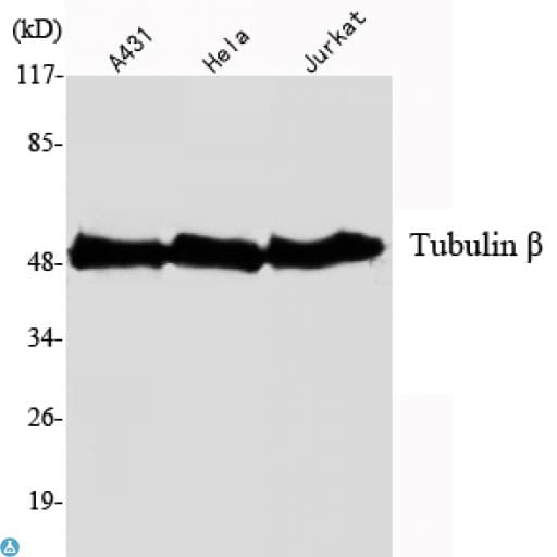 Monoclonal Mouse anti-Human Beta Tubulin Antibody (WB)