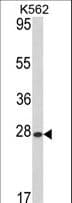 Polyclonal Rabbit anti-Human ARL1 Antibody (aa1-30, IHC, WB)