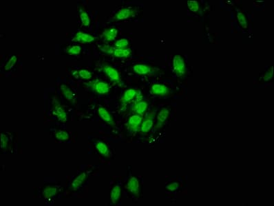 Polyclonal Rabbit anti-Human SIN3B Antibody (IHC, IF)