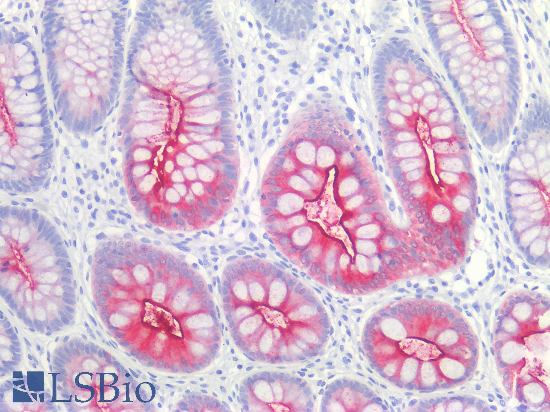 IHC-plus™ CEACAM5 / CD66e Antibody (clone C66/1009, Azide-free, BSA-free)