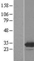 Human EMG1 / NEP1 Protein (Over-Expression Lysate Myc-DDK (Flag))
