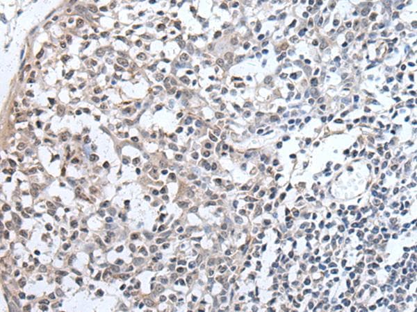 PLAG1 Antibody