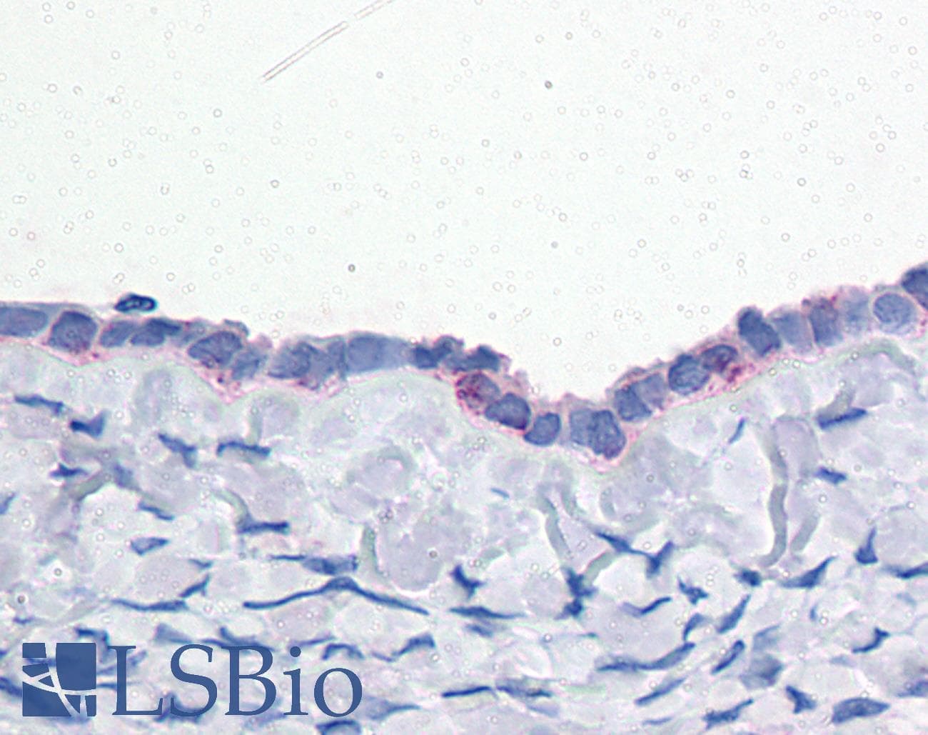 IHC-plus™ ENPP3 / CD203c Antibody (C-Terminus)