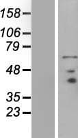 PRICKLE3 / LMO6 Protein (Over-Expression Lysate Myc-DDK (Flag))
