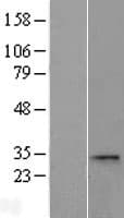 CCDC28A Protein (Over-Expression Lysate Myc-DDK (Flag))