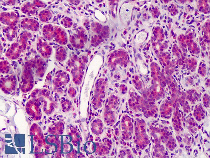 IHC-plus™ FANCC Antibody (C-Terminus, Preservative Free)