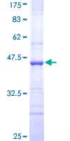 Human ABCC8 / SUR1 Protein (Recombinant GST, N-terminus)