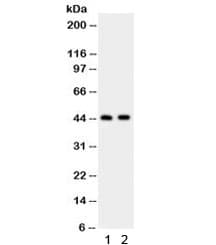 CTH / Cystathionase Antibody
