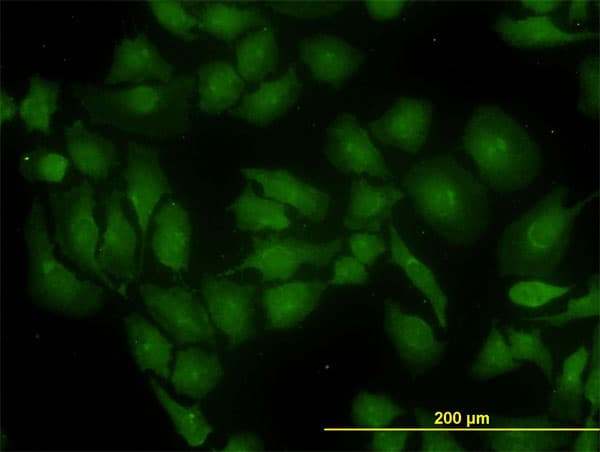 GLS / Glutaminase Antibody (clone 5C4)