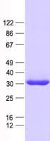 Human GLYAT Protein (Recombinant His, N-Terminal)