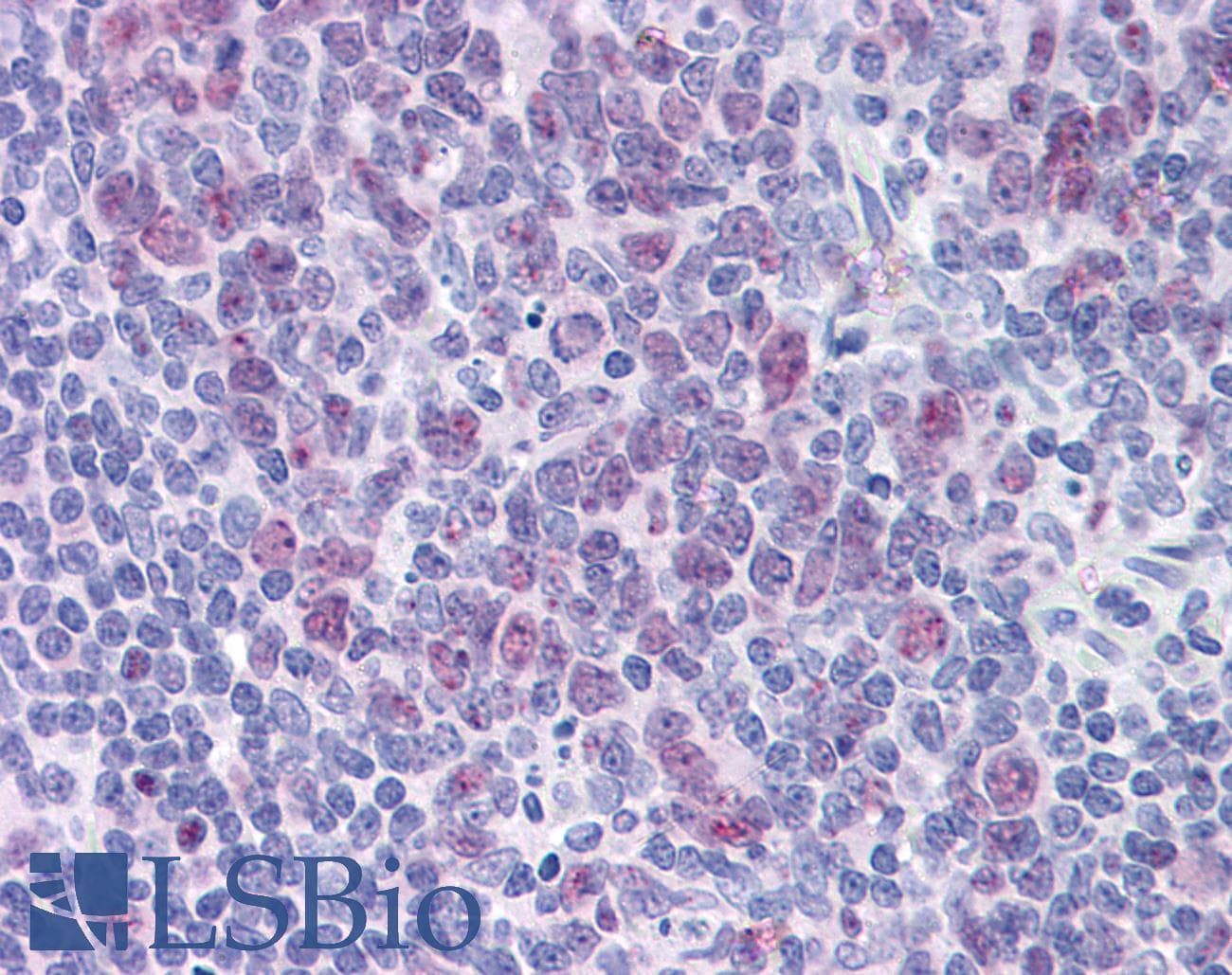 IHC-plus™ HDAC4 Antibody (clone 2B11)