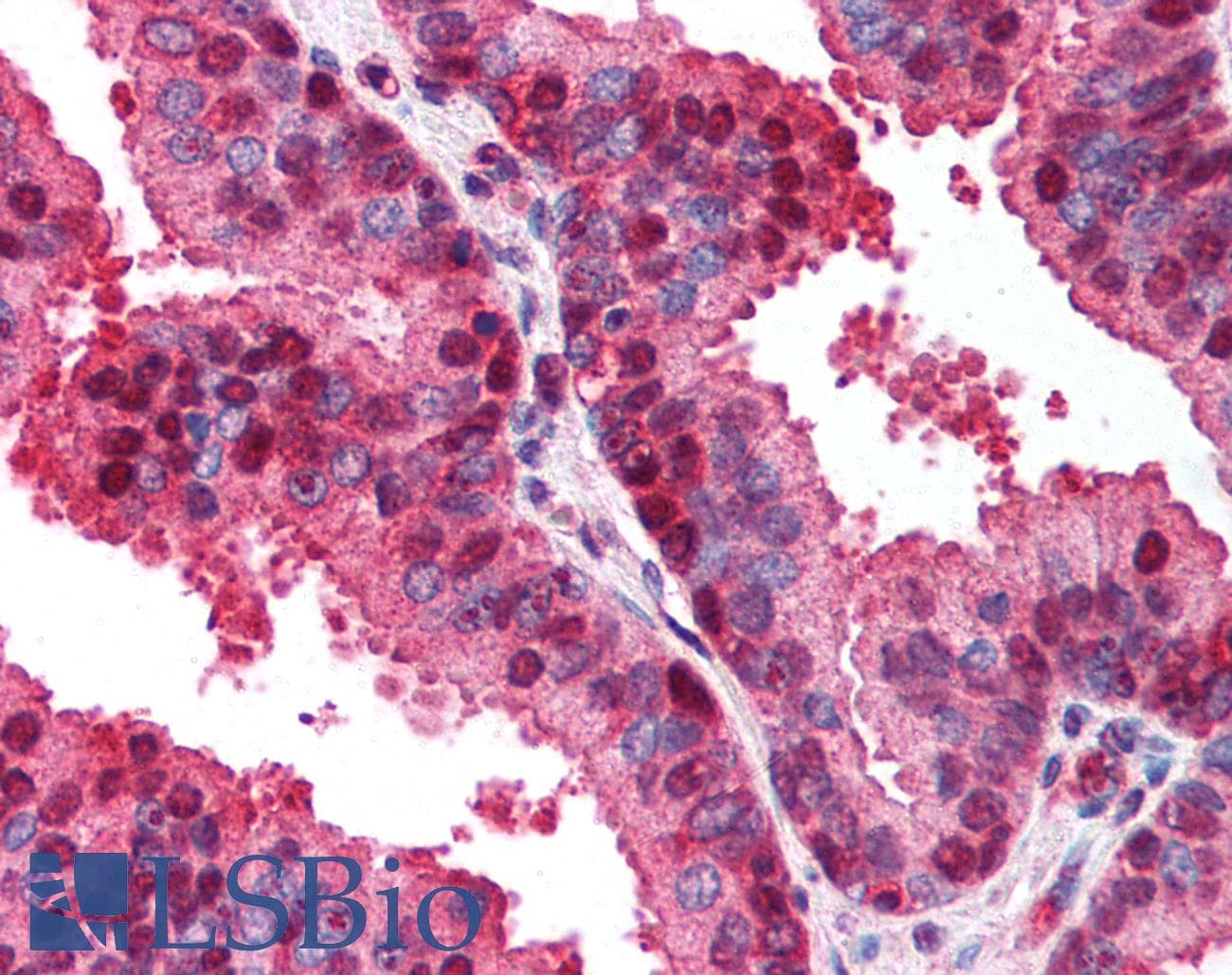 IHC-plus™ p16INK4a / CDKN2A Antibody