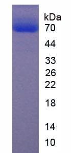Human ECM1 Protein (Recombinant His, N-Terminal)
