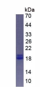 Mouse PTHLH / PTHRP Protein (Recombinant His, N-Terminal)