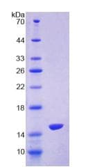 Human Oxytocin Protein (Recombinant His-T7, N-terminus)