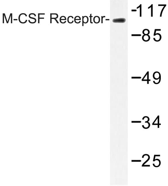 CSF1R / CD115 / FMS Antibody (Gln718)