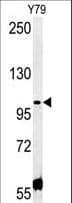 CCDC146 Antibody (aa113-141)
