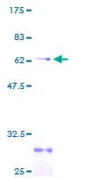Human CD1A Protein (Recombinant GST)