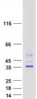 Human HSD17B7 / PRAP Protein (Recombinant Myc-DDK (Flag))