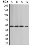 Polyclonal Rabbit anti-Human SMARCD1 / BAF60A Antibody (WB)