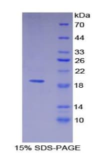 Human THBD / CD141 / Thrombomodulin Protein (Recombinant His)