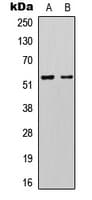 KCNK3 / OAT1 Antibody (N-Terminus)