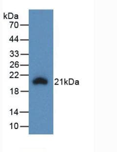 IL-1B / IL-1 Beta Antibody