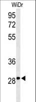 C9orf95 / NRK1 Antibody (aa24-50)