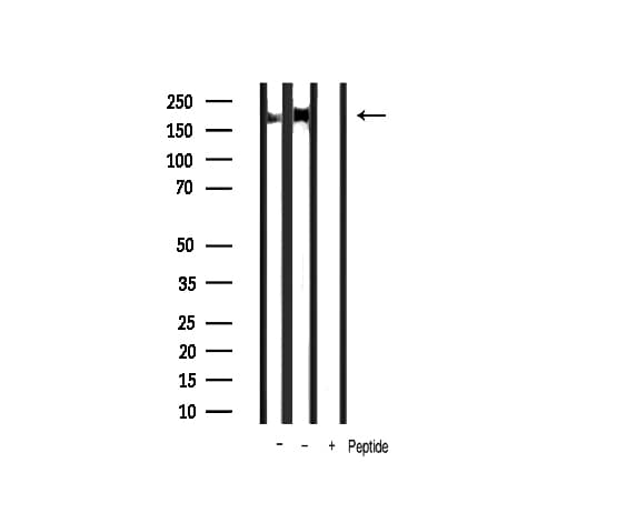 ERBB2 / HER2 Antibody (phospho-Tyr1248)
